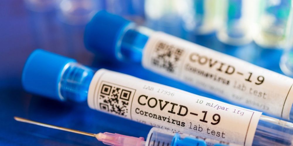Вакцинација радника у јавном сектору Вакцинација радника у јавном сектору